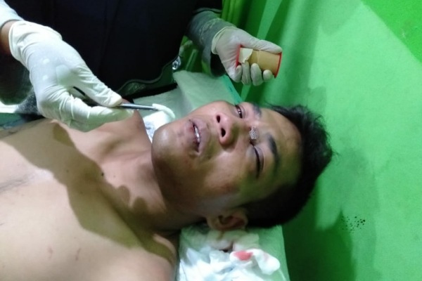 Tersangka curanmor Supadi alias Jhon (29) menjalani perawatan medis usai dihajar massa
