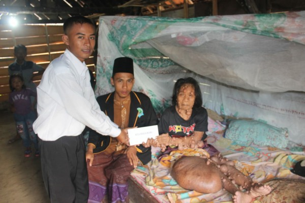 Perwakilan komunitas Kita Peduli, Paidi menyerahkan bantuan uang tunai kepada penderita tumor, Lasiyem (46)