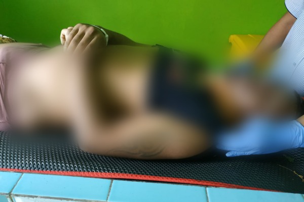 Jenazah korban Anri Boimau (27) setelah di lakukan otopsi