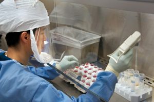 DENGAN ANGGARAN RP 5 M, BLORA SEGERA PUNYA PCR TES SWAB COVID-19